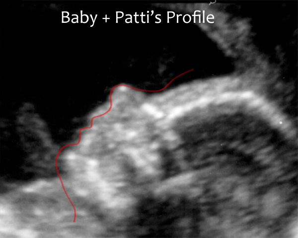 Ultrasound_Profile